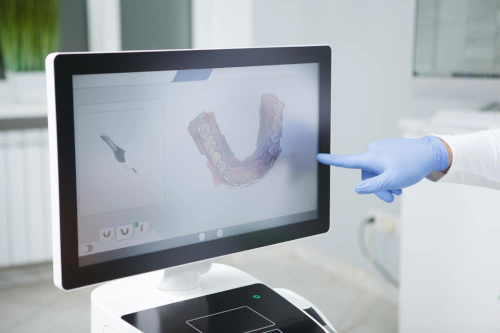 Digital Dental Scanner in Denver, CO at 58 Peaks Dental